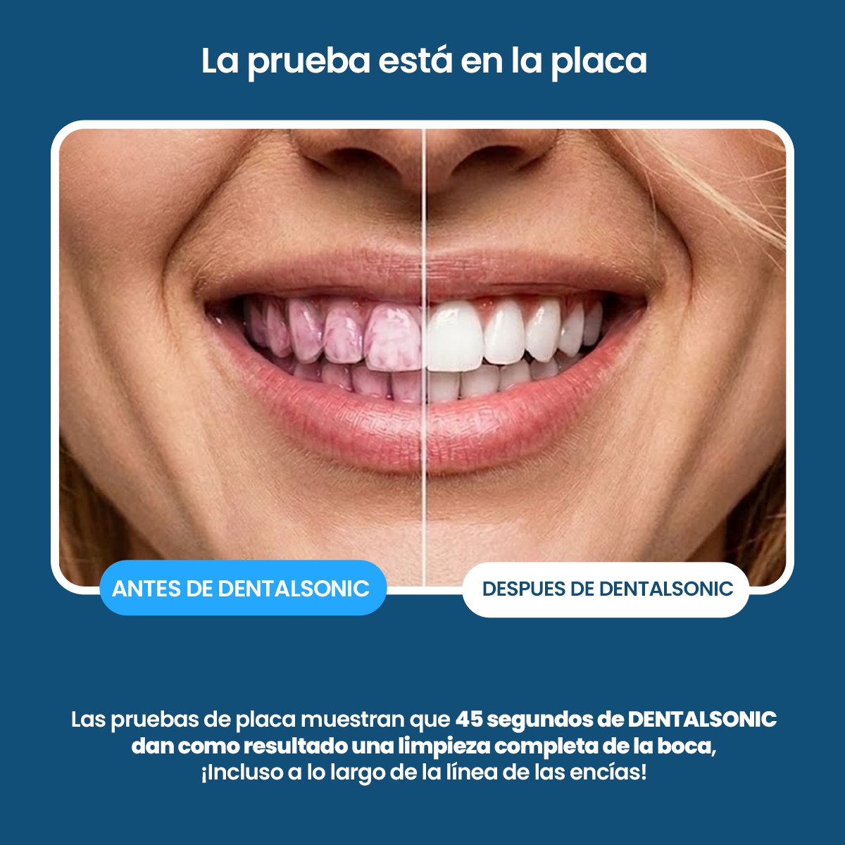 Cepillo Dental Sonic 360° Ultrasónico Blanqueador